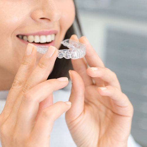 cuanto-dura-invisalign